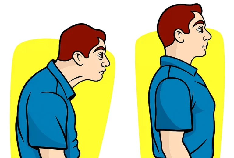 Rounded Shoulders & Hunchback 圆肩驼背